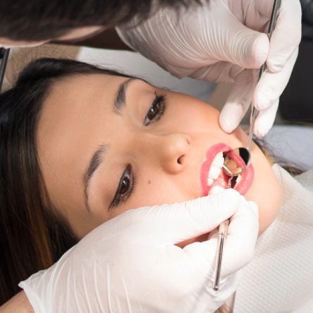 What Happens During a Tooth Extraction? Step-by-Step Guide