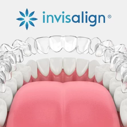 What-Is-Invisalign-and-How-Does-It-Work